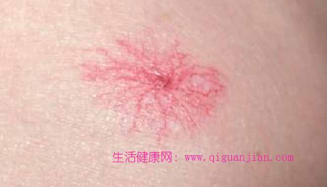 赶紧自查，身体出现这4个迹象，别等肝硬化才后悔！-养生文化-生活健康网